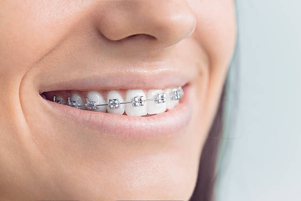 Best Teeth Whitening  in Valparaiso, FL
